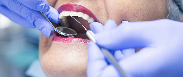 Best Emergency Tooth Extraction in Eugene, OR